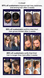 FEG Plus Hair Growth Spray – Hair Loss Solution