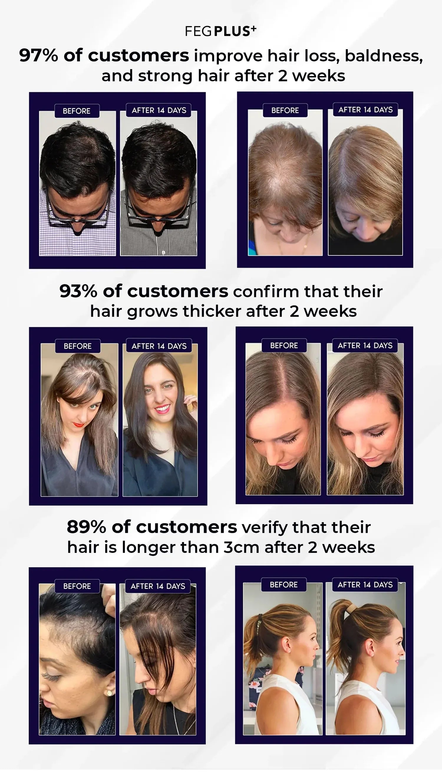 FEG Plus Hair Growth Spray – Hair Loss Solution